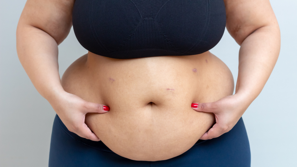 gordura abdominal